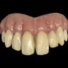 Trick Or Treat Studios Costumes & Props-Bitemares Horror Teeth - Goofy Teeth